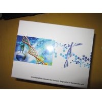 豚鼠肝細胞生長因子(HGF)ELISA試劑盒