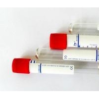 兔抗山羊IgG（H+L）抗血清 廠家直銷
