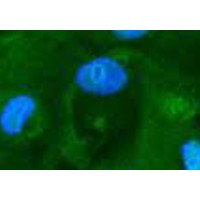 Actin-EGFP穩(wěn)轉(zhuǎn)細胞株，Hela