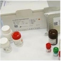 甲型流感H1熒光PCR試劑盒